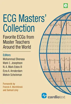ECG Masters’ Collection Favorite ECGs from Master Teachers Around the World